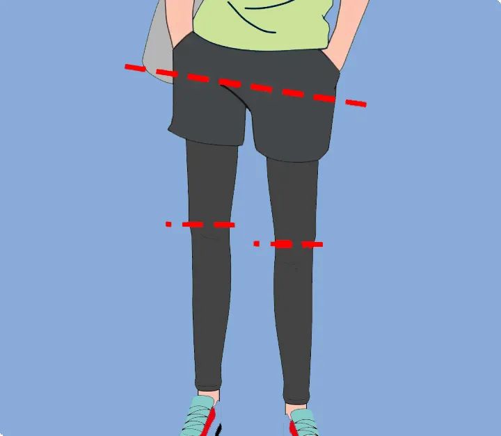 長短腿