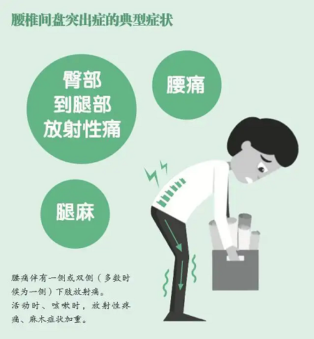 椎間盤突出典型癥狀