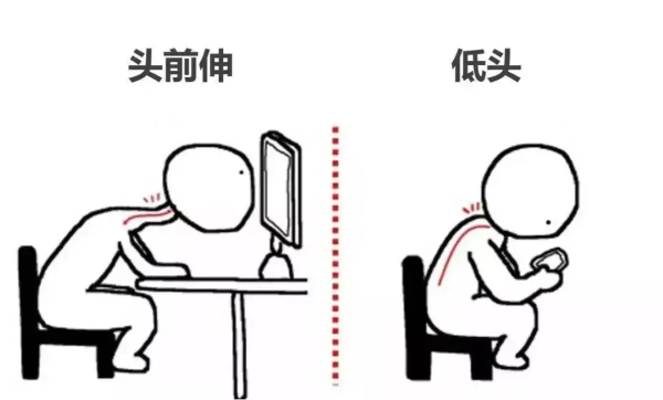 頸椎不良姿勢(shì)