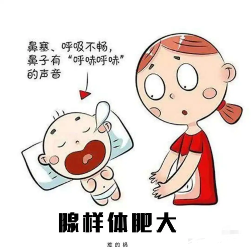 鼻塞張口呼吸